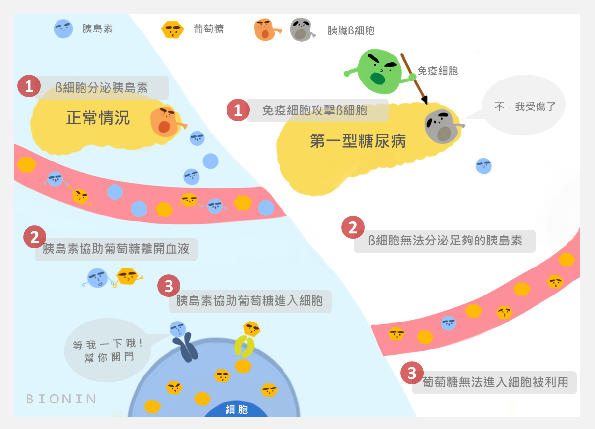 正常情況下與第一型糖尿病的差別